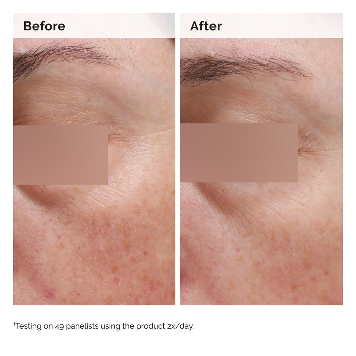 niacinamide-5-face-and-body-emulsion-m4 2024-08-23-ORD-Nia-5pct-Face-Body-B-A-Elasticity-Global-02-1x1.jpg