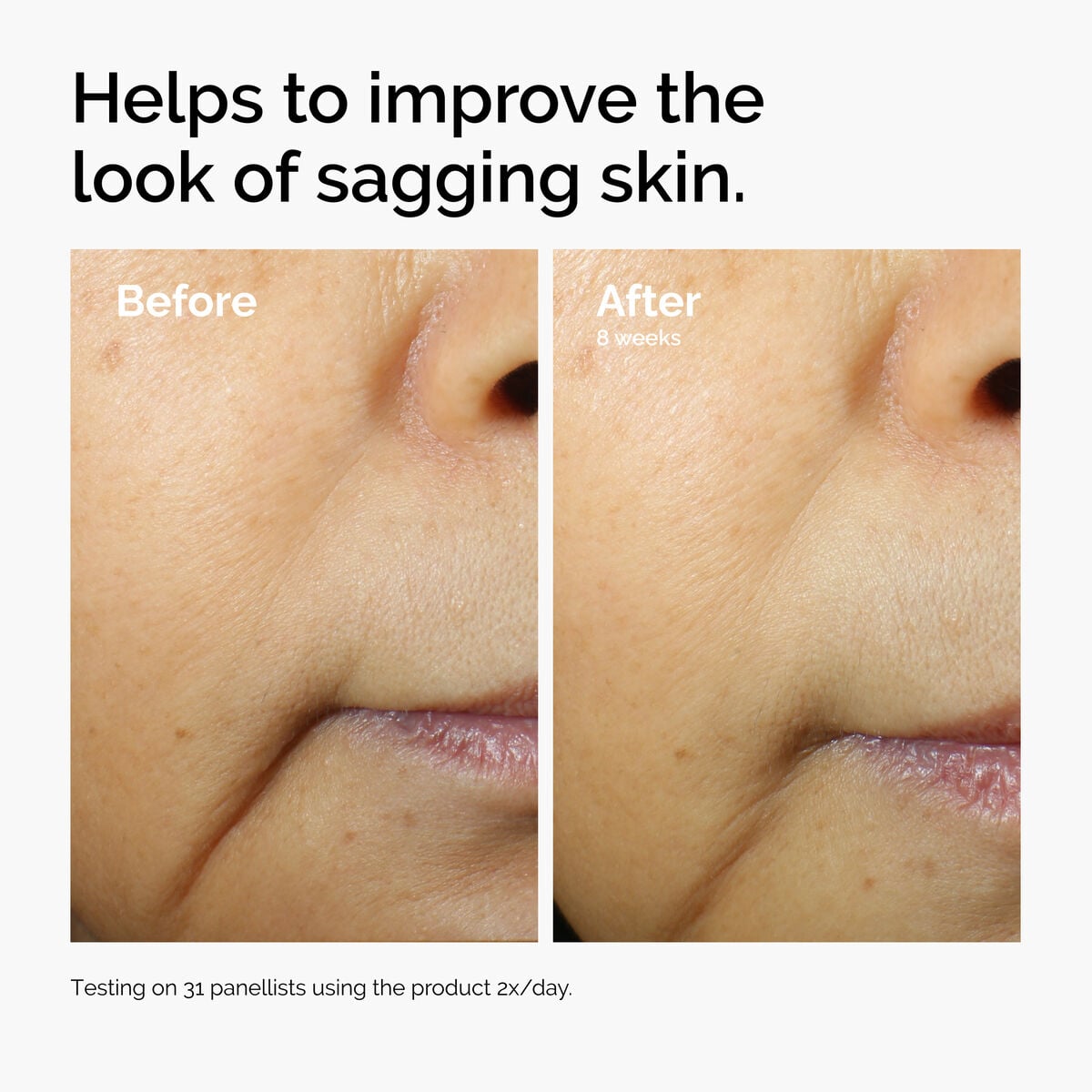 caffeine-3-escin-1-face-serum-f1 ord-caffeine-3pct-escin-1pct-face-serum-before-after-sagging.jpg