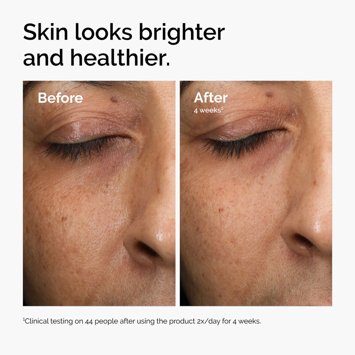 multi-antioxidant-radiance-serum-e6 ord-mars-before-after-healthy.jpg