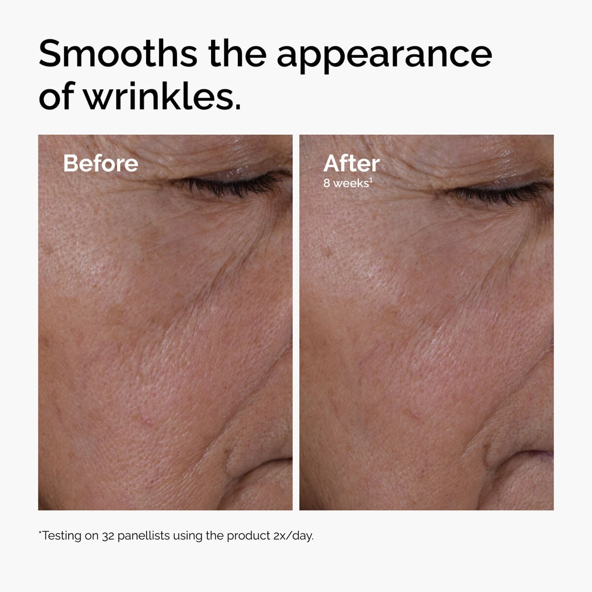 multi-peptide-ha-serum-e4 ord-multi-peptide-ha-serum-wrinkles-before-after.jpg