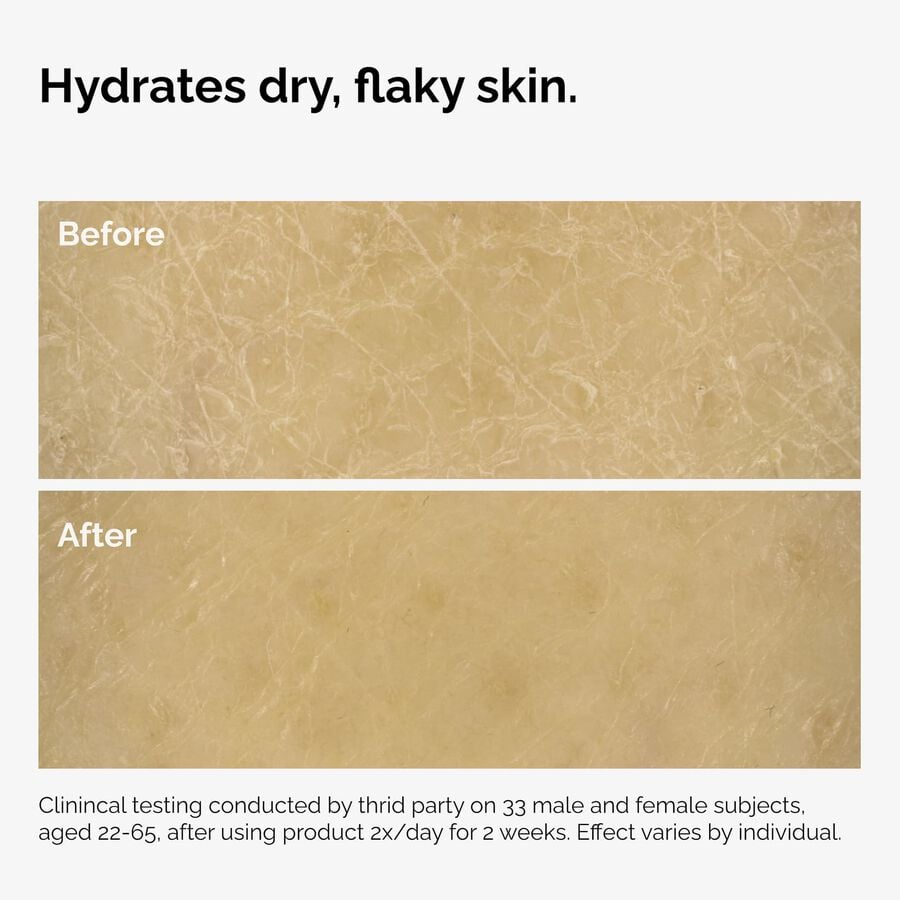 the-body-care-collection-j9 ord-natural-moisturizing-factors-inulin-body-before-after-graphic-02.jpg