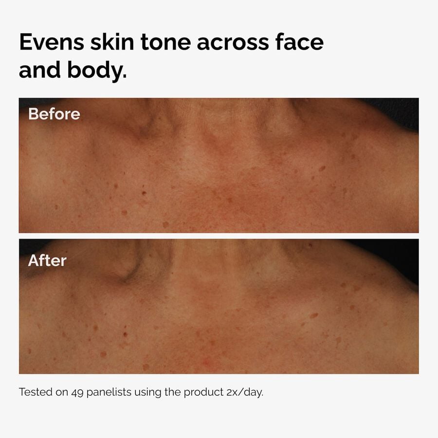 the-body-care-collection-j9 ord-niacinamide-face-body-serum-before-after-even-tone-graphic.jpg