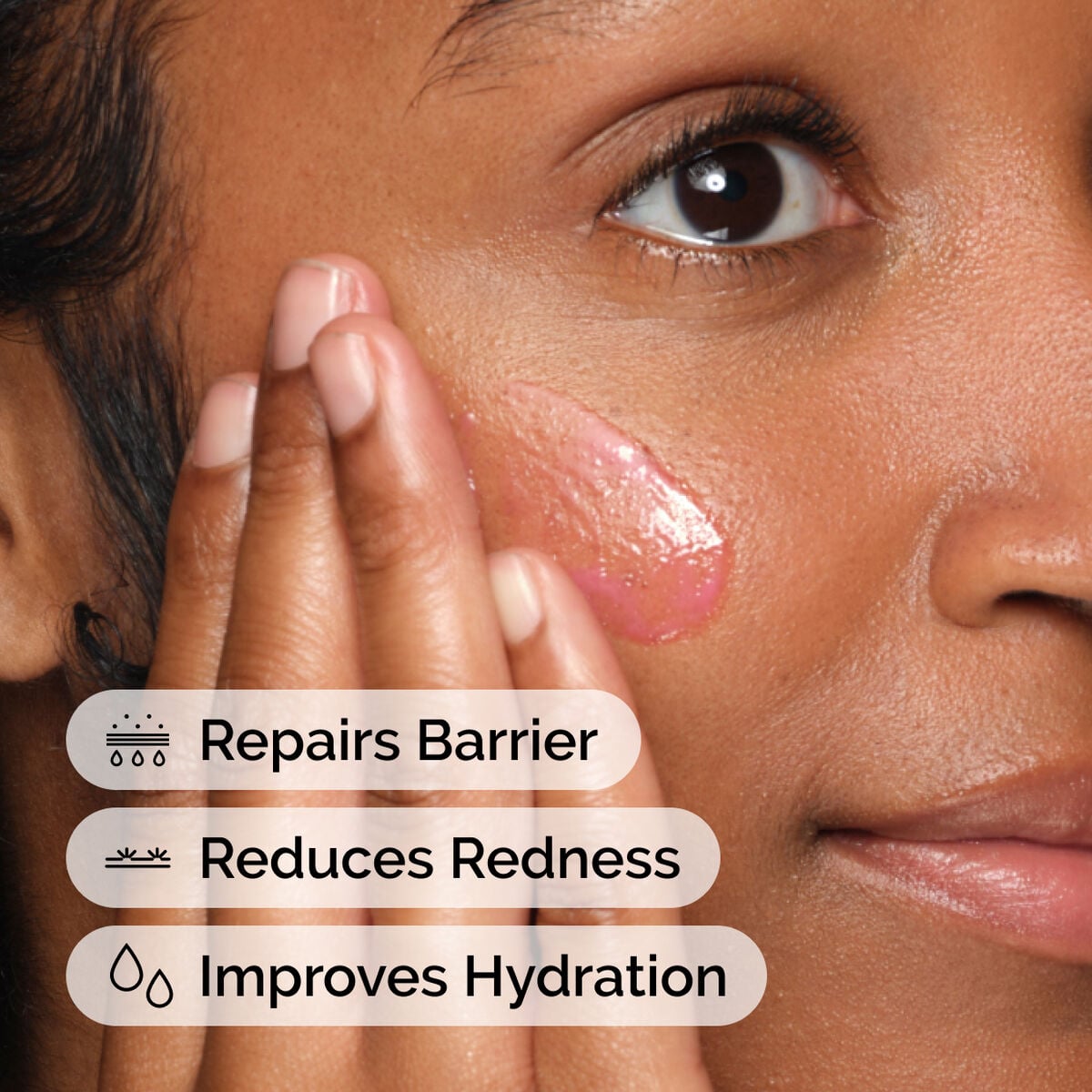 soothing-and-barrier-support-serum-set-v7 ord-soothing-barrier-support-serum-model-application-with-benefits.jpg