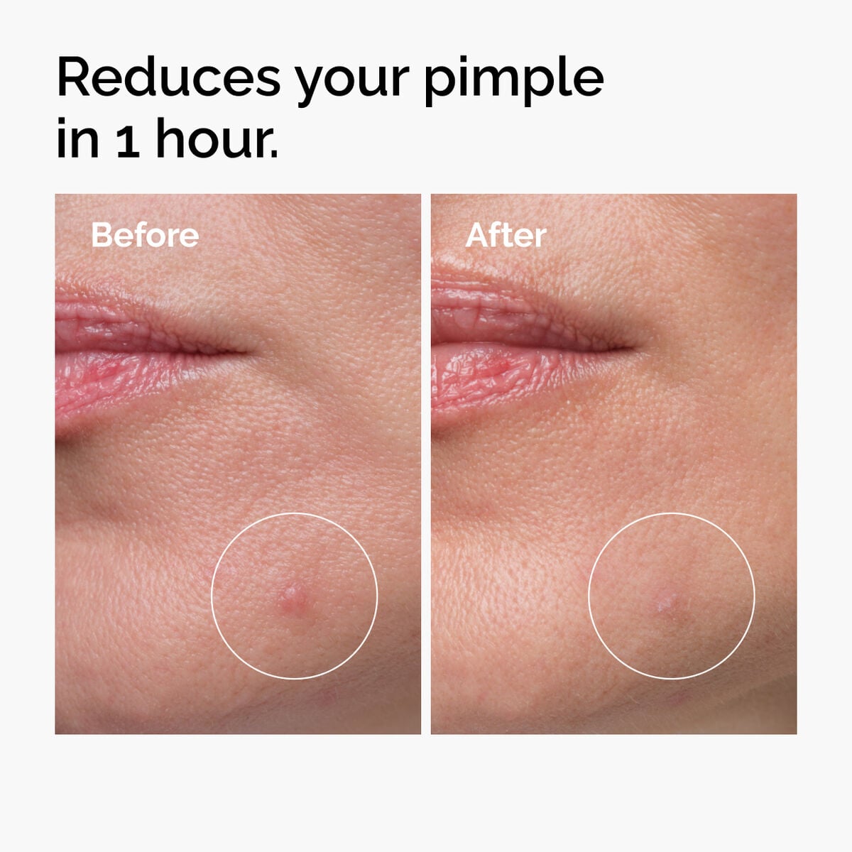 sulfur-10-powder-to-cream-concentrate-h2 ord-sulfur-10pct-powder-to-cream-concentrate-before-after-NA.jpg